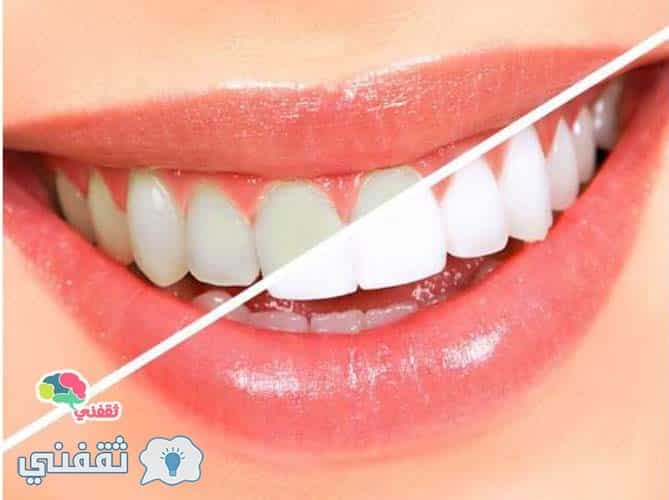 أعرف أفضل طريقة من أجل تبييض الأسنان بأستخدام ملح الطعام