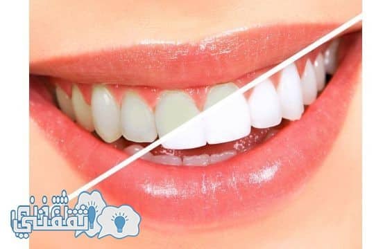 أسهل الماسكات الطبيعية لأزالة أصفرار الاسنان وتبيضها من أول أستخدام
