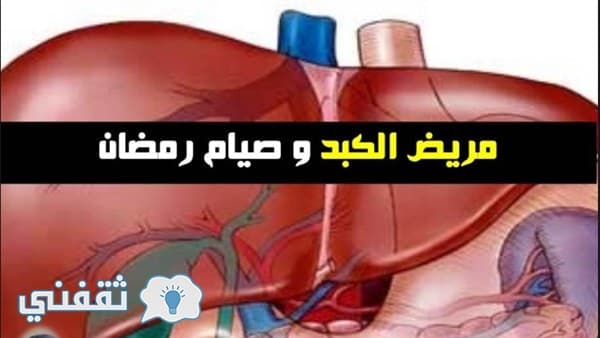 نصائح مهمة لمرضى الكبد في شهر رمضان