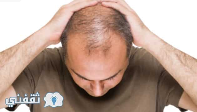 علاج تساقط الشعر