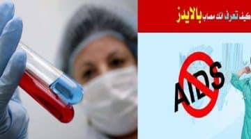 تصريح خطير من وزارة الصحة عن المصابين بمرض الإيدز في مصر