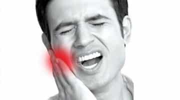 تخفيف ألم الأسنان
