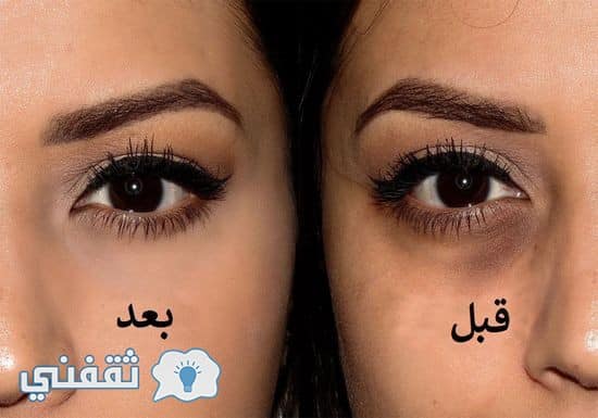 نصائح هامة لمنع ظهور الهالات السوداء تحت العين و العناية بالبشرة