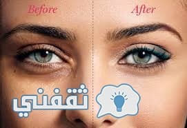نصائح هامة لمنع ظهور الهالات السوداء تحت العين و العناية بالبشرة