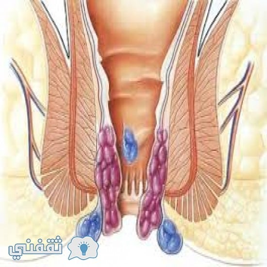 علامات تدل على أنك مصاب بسرطان الشرج