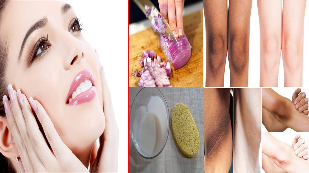 تبييض المناطق الحساسة بالبصل فوراً وبدون أي تكلفة وصفة فعالة وآمنة للحامل والمرضع