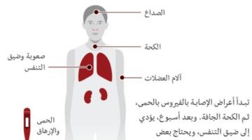 3 أعراض لكورونا تؤكد موت صاحبها