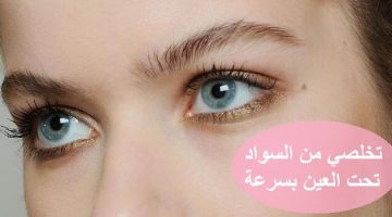 حل نهائي لعلاج الهالات السوداء