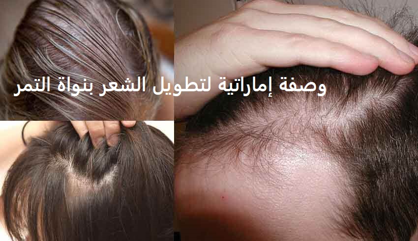 وصفة إماراتية لتطويل الشعر بنواة التمر تملأ فراغات الشعر وإنبات مقدمة الرأس بسرعة