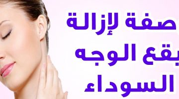 البقع الداكنة