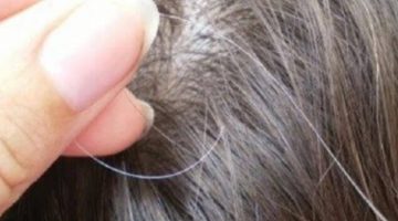 علاج الشعر الابيض ومنع ظهور الشيب المبكر