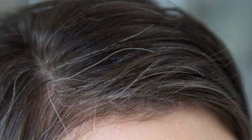 علاج الشعر الابيض والشيب المبكر في المنزل بدون صبغة