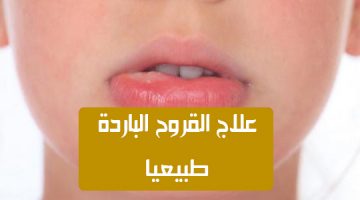 علاج حبوب حول الفم