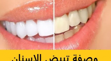 اسباب تبييض الاسنان