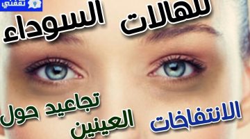 إزالة تجاعيد حول العين