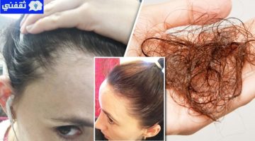 علاج تساقط وجفاف وهيشان الشعر