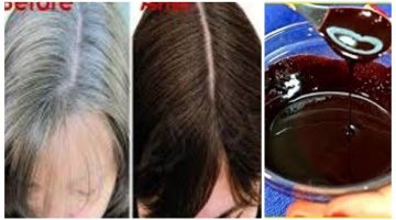وصفات طبيعية للتخلص من شيب الشعر