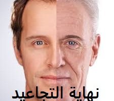 معالجة التجاعيد