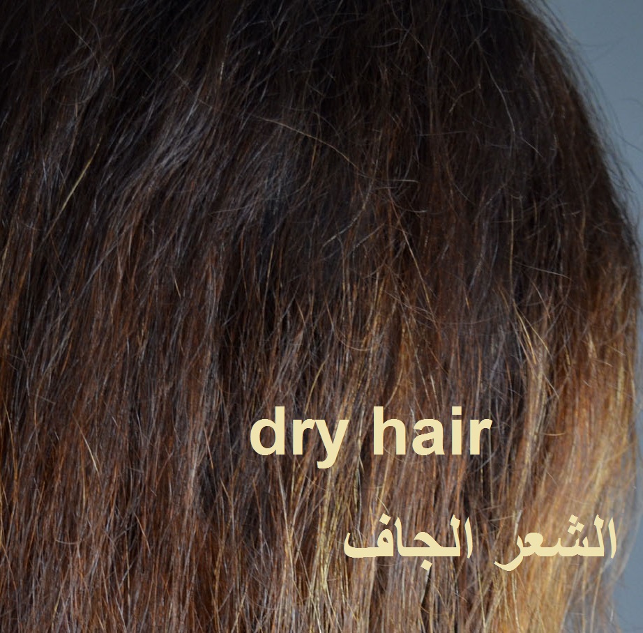 أنواع الشعر