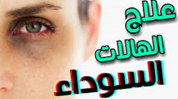 علاج الهالات السوداء