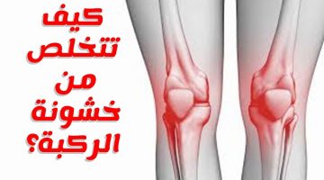 علاج خشونة الركبة