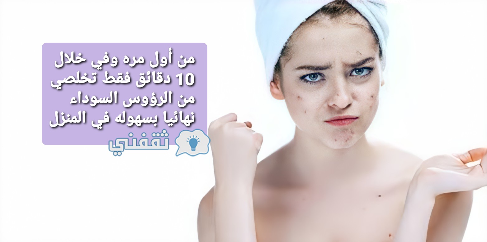 من أول مرة وفي خلال 10 دقائق فقط تخلصي من الرؤوس السوداء نهائيا بسهولة في المنزل ثقفني