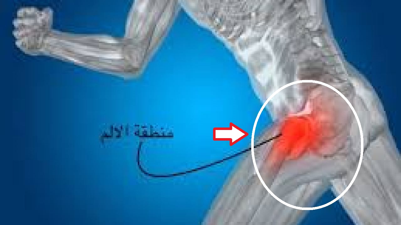 طريقة التخلص من التهاب المفاصل المنتشر خلال فصل الشتاء