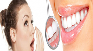 وصفة لتبييض الأسنان وازالة الرواسب