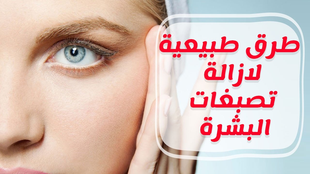 طرق طبيعية لعلاج تصبغات الوجه
