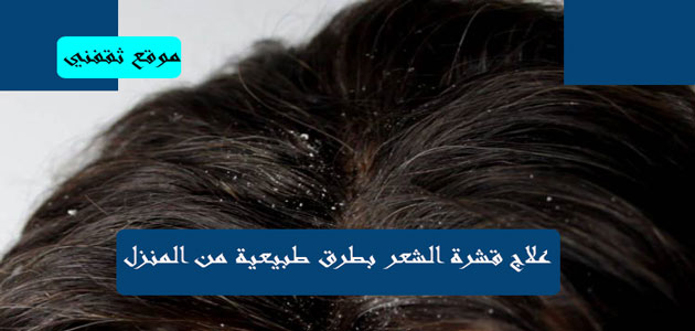 علاج قشرة الشعر نهائيًا بطرق طبيعية وغير اعتيادية من المنزل