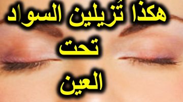 علاج اسمرار تحت العين