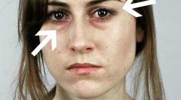 علامات صحية على الوجه تبين مشاكل بالجسم
