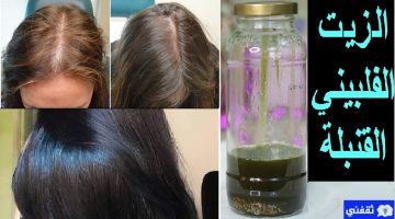 علاج تساقط الشعر وإنبات الفراغات