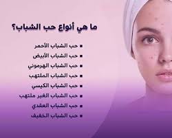 طرق طبيعية للتخلص من حبوب الشباب