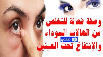 وصفة للتخلص من الهالات السوداء