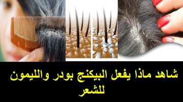 علاج قشرة الشعر بوصفات طبيعية