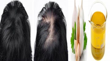 وصفات تعزيز نمو الشعر وإنبات الفراغات