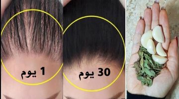 طرق طبيعية لعلاج تساقط الشعر