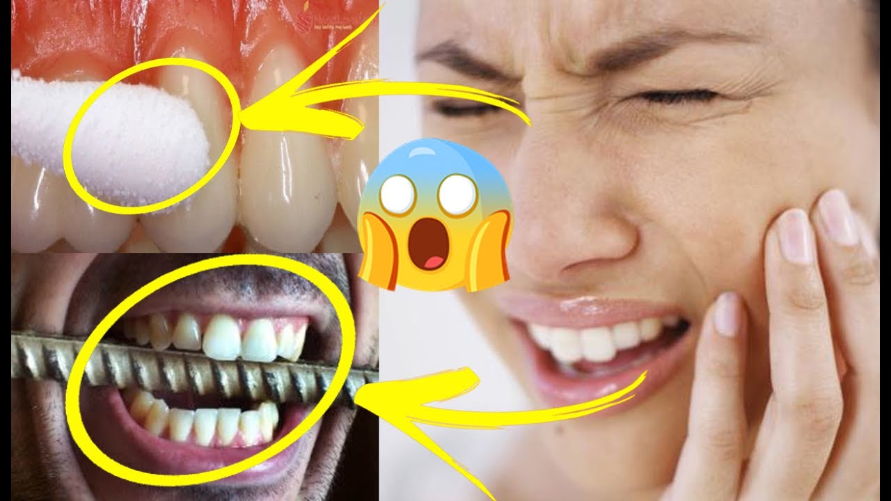 آلام الأسنان والتهاب اللثة