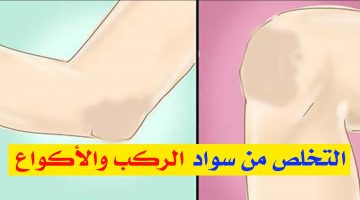 خلطات طبيعية لعلاج سواد الركب والتخلص منه بسهولة في المنزل