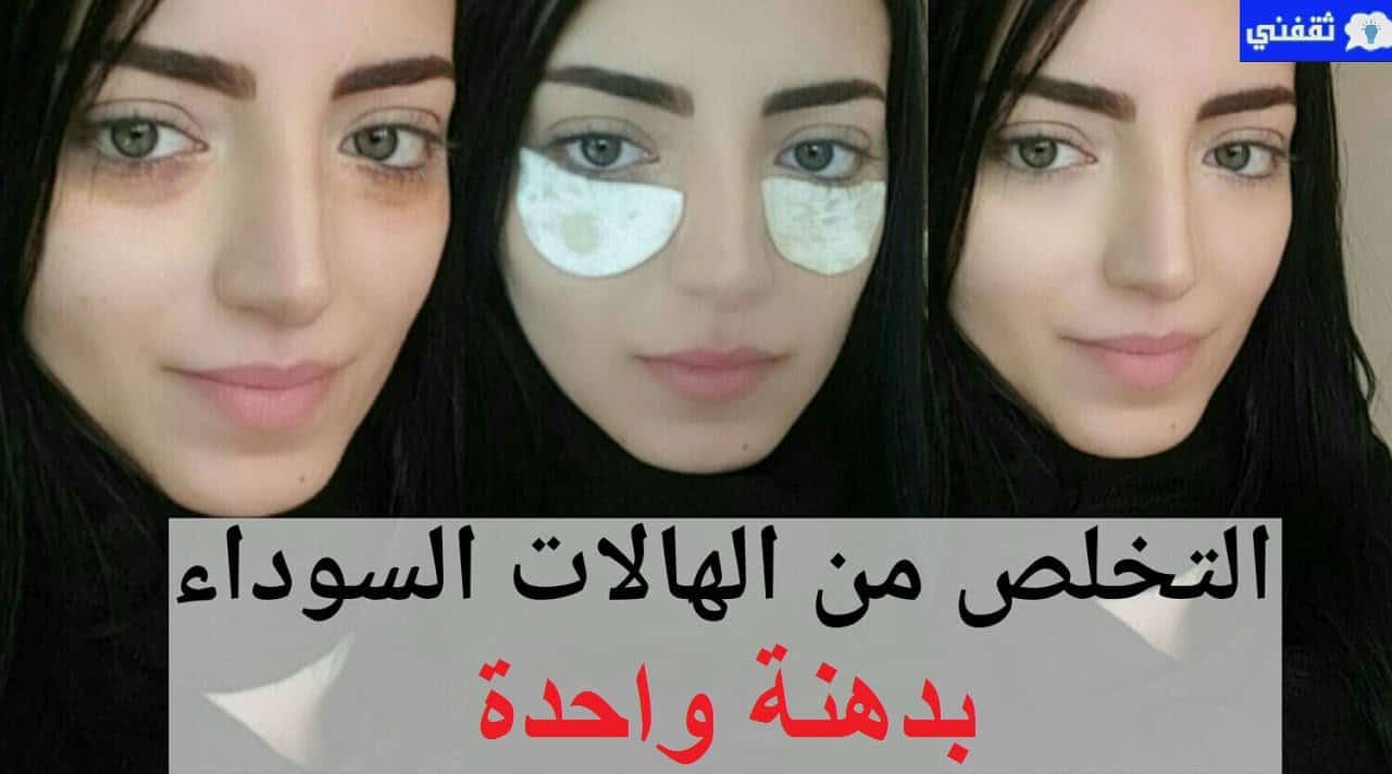 علاج الهالات السوداء والتجاعيد حول العينين