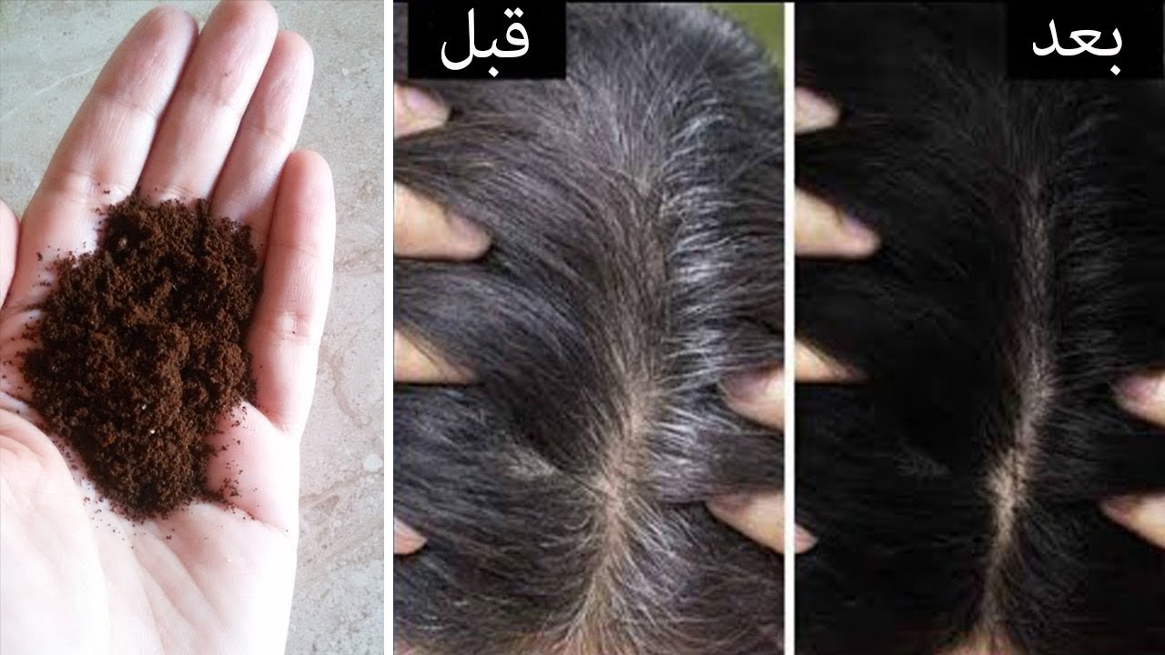 وصفات طبيعية للقضاء على الشعر الابيض