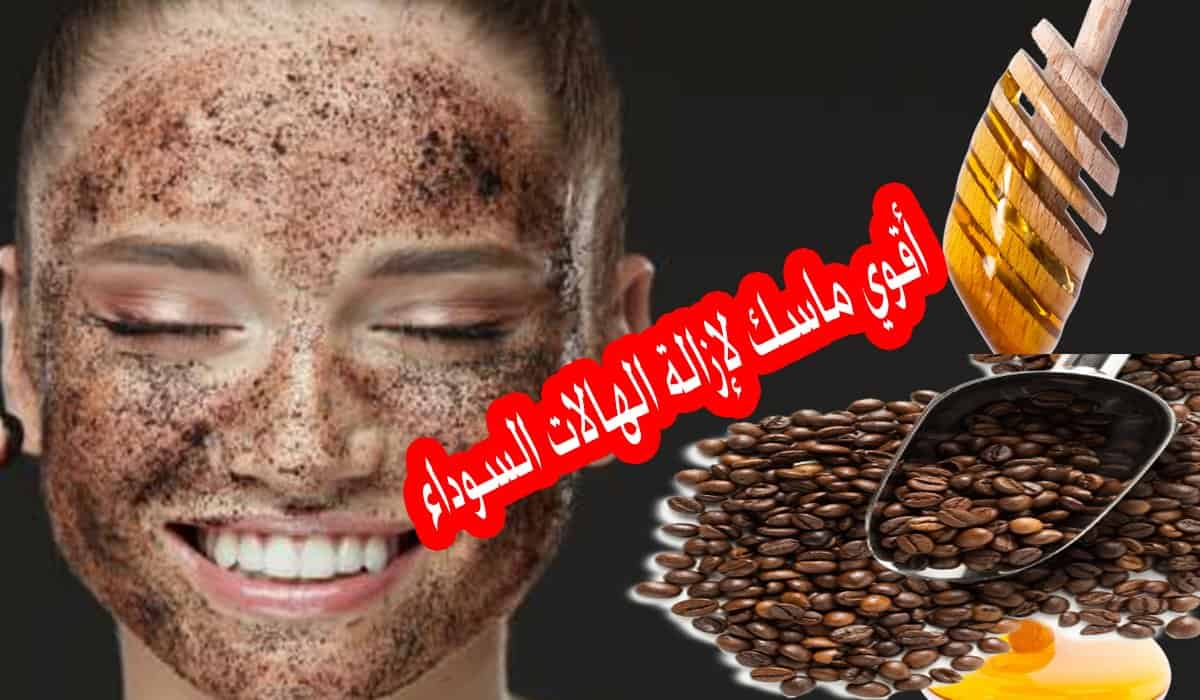 اسمرار تحت العينين