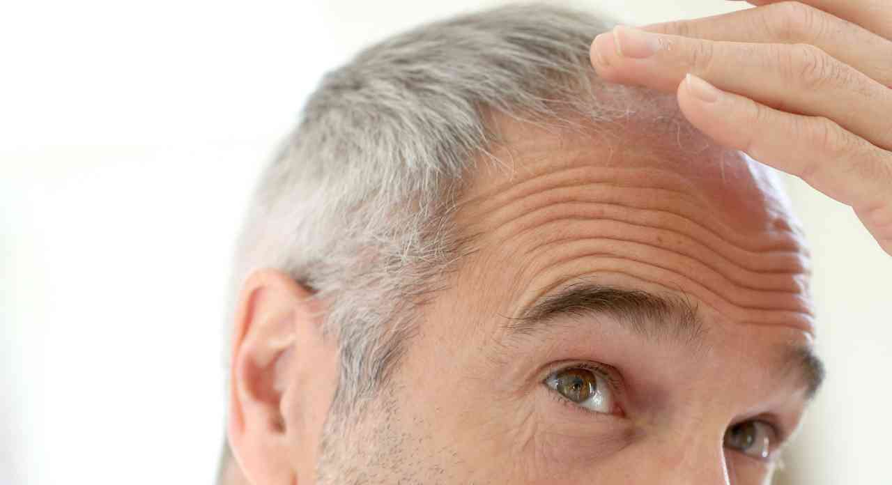 عوامل ظهور الشعر الأبيض