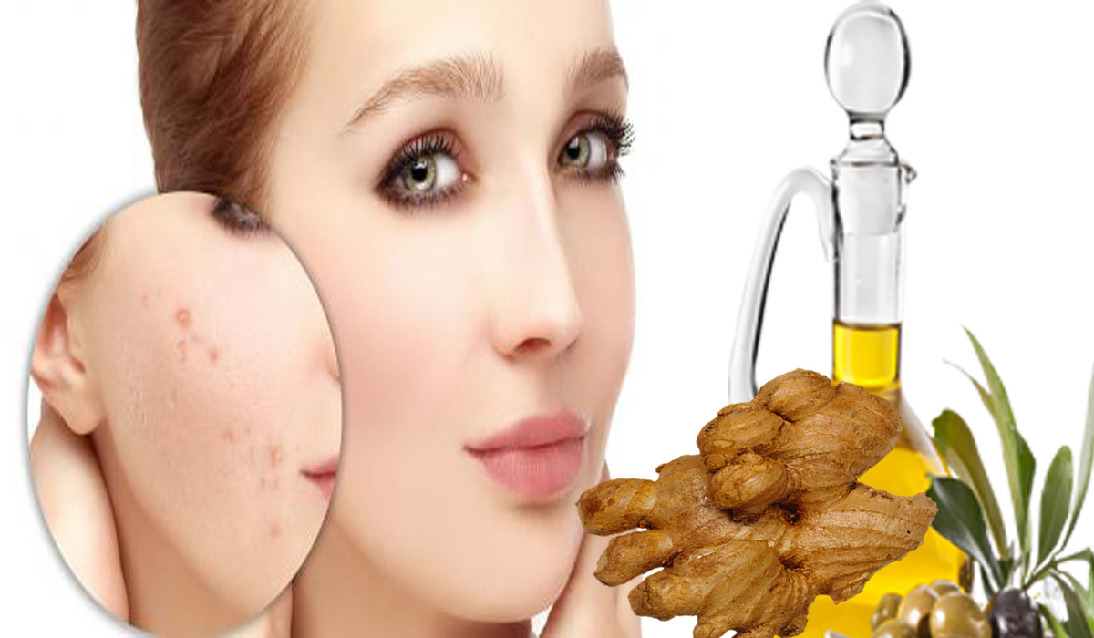 أفضل وصفة لعلاج حبوب الوجه والرؤوس السوداء لبشرة نظيفة ومثالية ثقفني