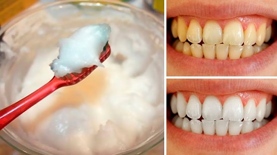 افضل طريقة لتبييض الأسنان في يوم واحد فقط بمكونات بسيطة