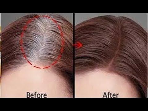 خليط عراقي قنبلة لصبغ الشعر الابيض سريعا افضل علاج للتخلص من شيب الشعر