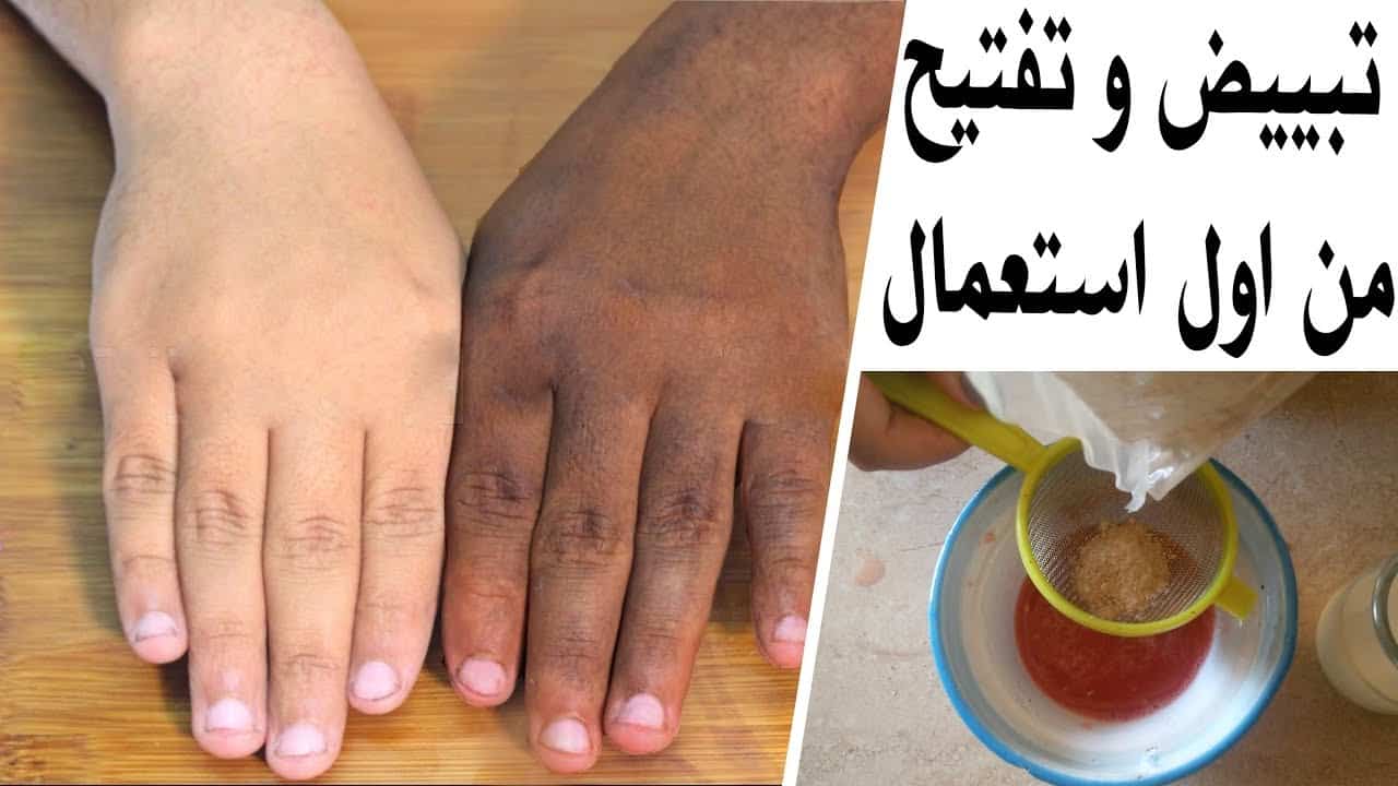 مفاجأة لعرايس العيد أقوي كريم تبييض الجسم والعانة والبشرة