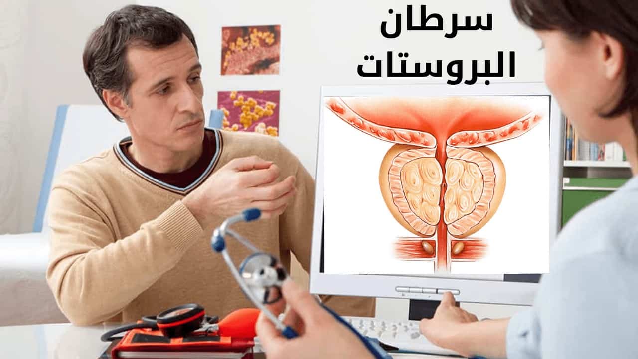 أعراض سرطان البروستات و طرق الوقاية منه