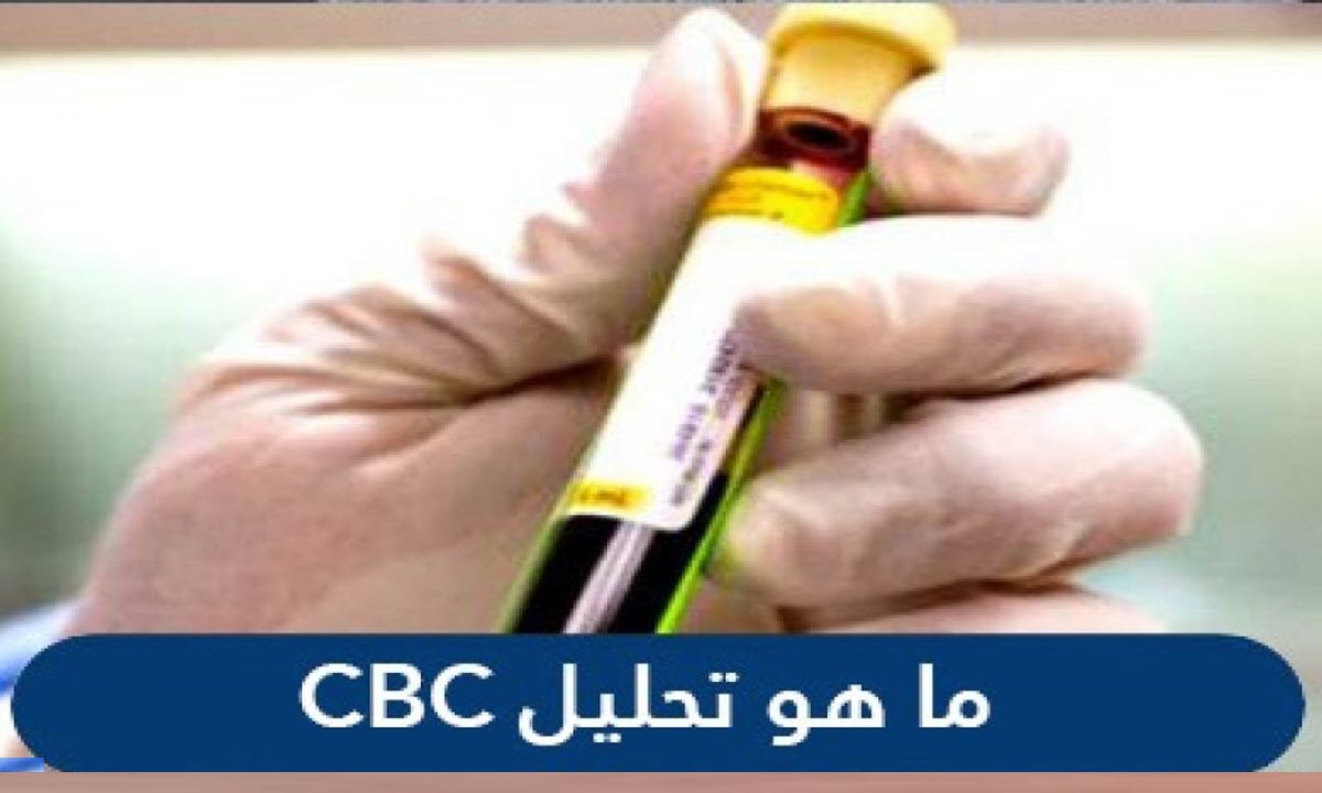 تحليل CBC